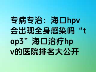 专病专治：海口hpv会出现全身感染吗“top3”海口治疗hpv的医院排名大公开