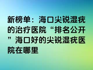 新榜单：海口尖锐湿疣的治疗医院“排名公开”海口好的尖锐湿疣医院在哪里